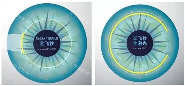 娄底市中心医院眼科收费标准公布，近视手术10000起/白内障8000起/斜视6000起！