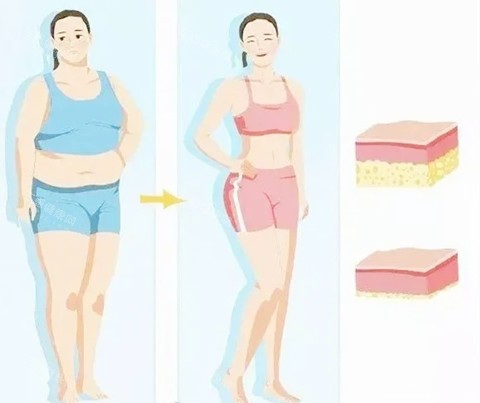 吸脂卡通对比 吸脂卡通对比