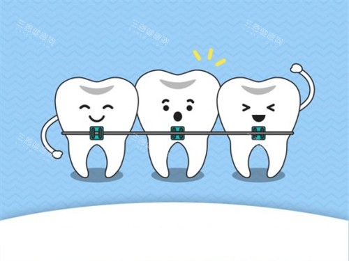 牙齿矫正动画示意图