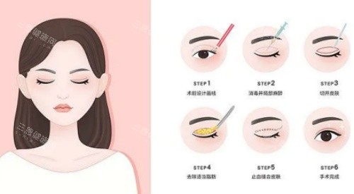 宁波艺星时代整形医院是正规的吗？资质认证+医师实力全解析