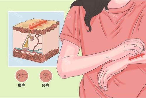 上海SRT100探店实录:江城皮肤医院的疤痕克星技术究竟有多香