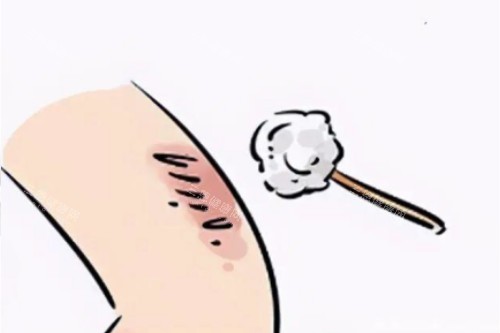 皮肤疤痕卡通图片展示