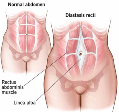 郑州腹壁整形医院深度探店:韩辰华领|圣熙格兰|河南整形美容医院怎么选才不踩坑