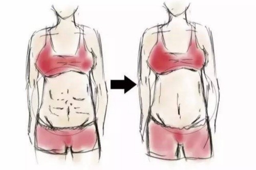 腹壁成型术卡通对比图 腹壁成型术卡通对比图
