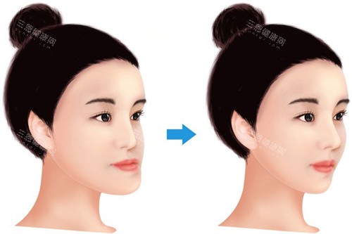 大连医学大学附属口腔医院预约挂号攻略！每日20点放8天号源，微信/电话/官网3种方式，正畸科抢号技巧藏这