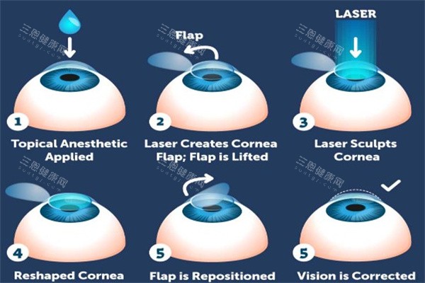 2026福建医科大学附属第一医院眼科价目表重磅更新！全飞秒1.2万起+白内障报销92%，夜间门诊还能约