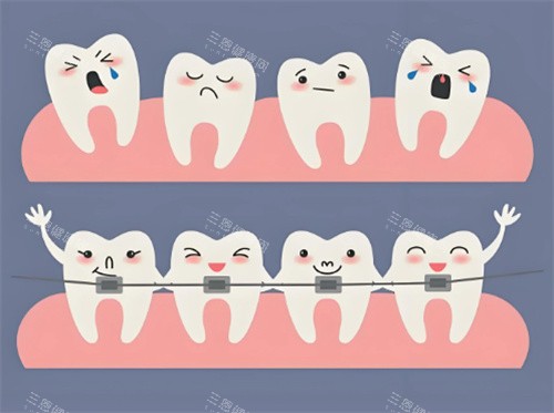别再盲目整牙！牙医良心忠告，从矫正方案到保持器佩戴全解析