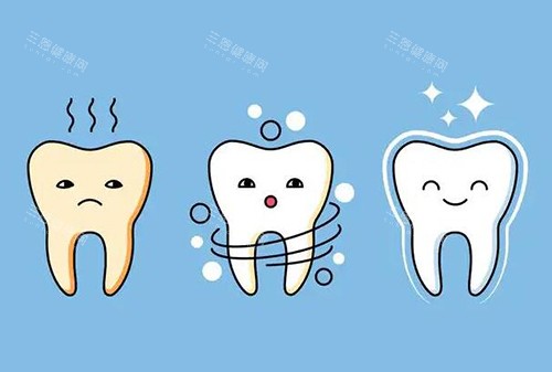 牙齿美白改善卡通图展示