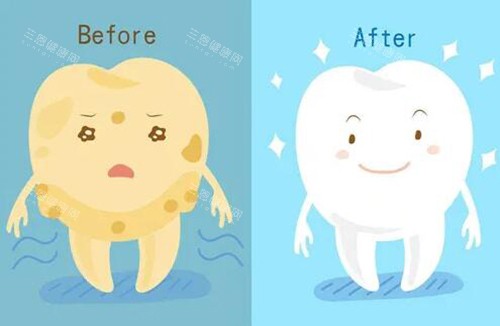 牙齿美白改善图卡通