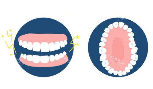 牙齿排列图 牙齿排列图