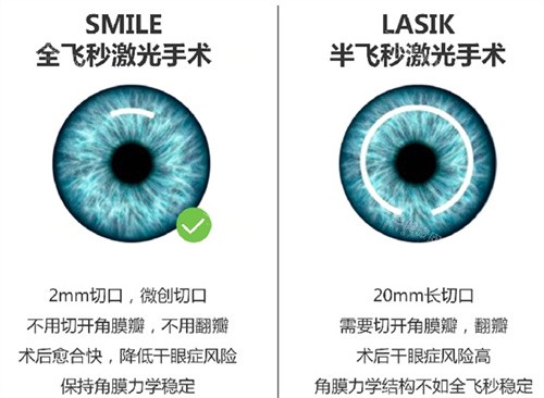 安顺市中心医院眼科收费价目表查询，近视矫正/白内障/斜视/青光眼等费用都有！