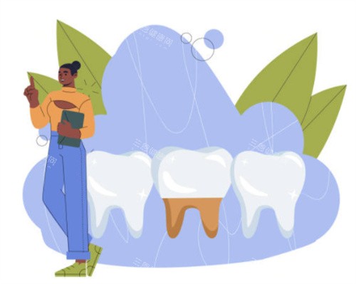 种植牙模拟图 种植牙模拟图