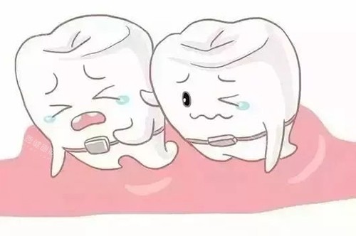 牙齿矫正卡通 牙齿矫正卡通