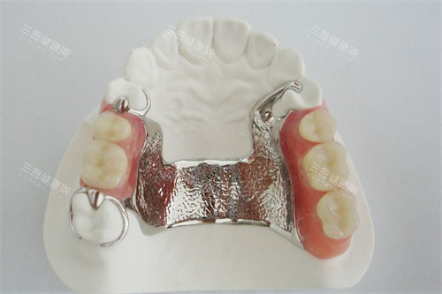 维他灵活动义齿成品 维他灵活动义齿成品