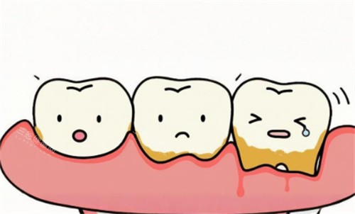 牙周炎动画图 牙周炎动画图