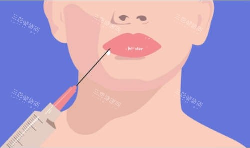 注射美容卡通图 注射美容卡通图