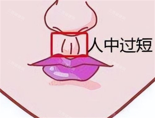 人中过短的样子图片