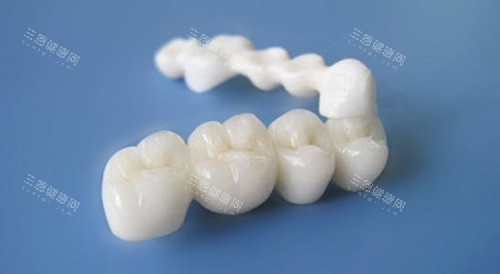 全瓷牙半口展示图