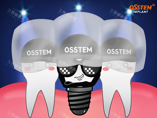 奥齿泰种植牙卡通图