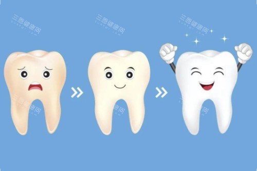 牙齿美白顺序图 牙齿美白顺序图