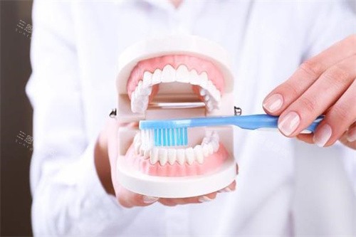 牙齿模型放大图 牙齿模型放大图