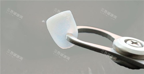超薄牙齿贴面 超薄牙齿贴面