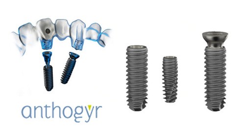 安卓健种植牙修复 安卓健种植牙修复