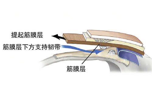 SMAS筋膜层图片展示 SMAS筋膜层图片展示