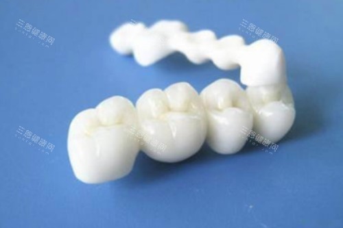 全瓷牙冠模型一览图 全瓷牙冠模型一览图