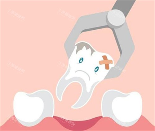 牙齿拔除卡通图