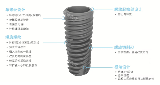 科惠种植牙怎么样细节照片 科惠种植牙怎么样细节照片