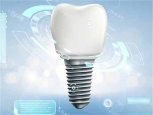 种植牙背景图 种植牙背景图