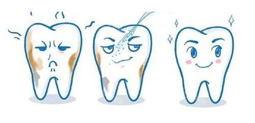 洗牙后的成效 洗牙后的成效