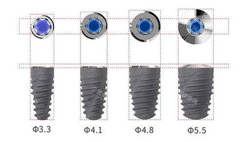 卡尔斯种植牙植体型号 卡尔斯种植牙植体型号