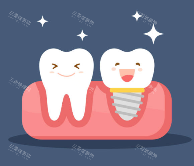 种植牙和正常牙齿图 种植牙和正常牙齿图