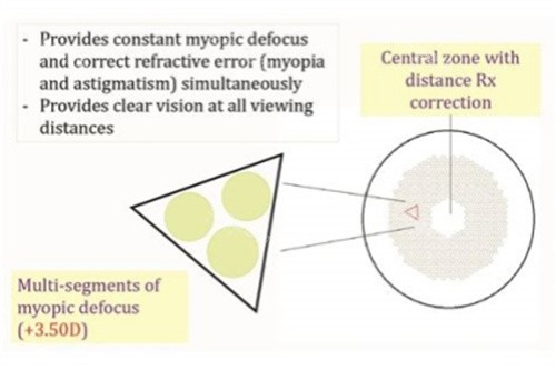 离焦镜片原理图