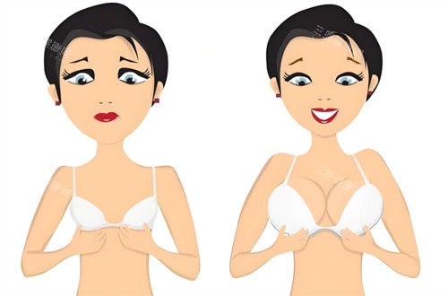隆胸对比图 隆胸对比图