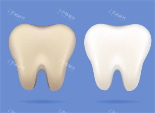 牙齿美白前后图 牙齿美白前后图