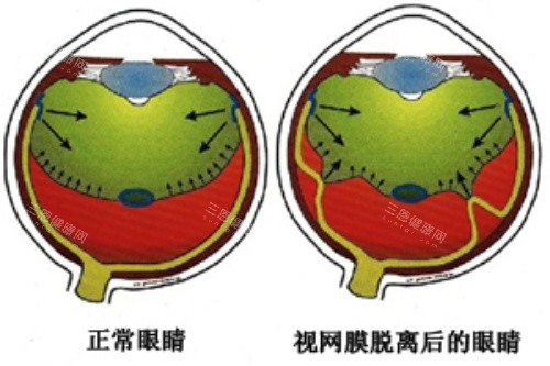 赵培泉手术排队多长时间？排队3个月起|从初诊到手术全流程时间表及预约抢号方式攻略