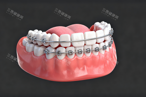 传统自锁矫正器展示 传统自锁矫正器展示