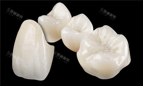 lava全瓷牙牙冠展示 lava全瓷牙牙冠展示