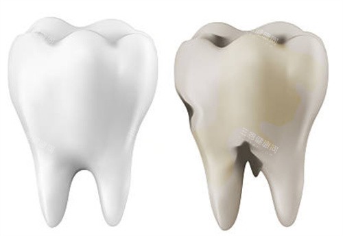 正常牙齿和坏的牙齿