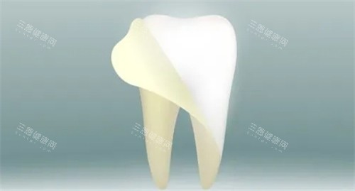 牙齿美白改善牙黄问题