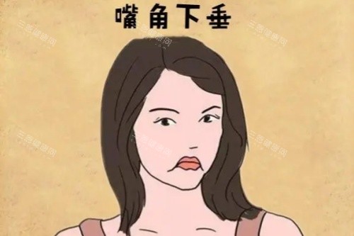 嘴角下垂卡通图