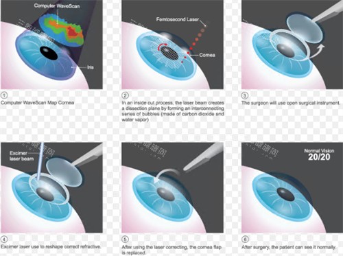 全飞秒过程演示 全飞秒过程演示