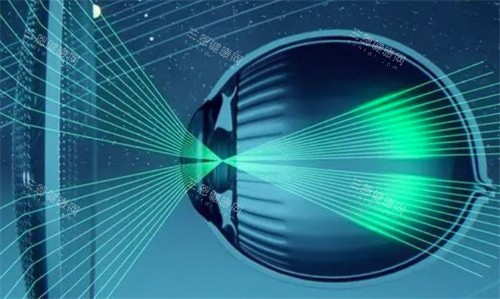 星趣控镜片示意图