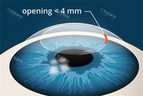 江门市中心医院眼科收费价目表:近视眼|白内障|角膜塑形镜|斜视|青光眼|老花眼价格表一览！