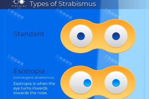 正常眼对比斜视眼