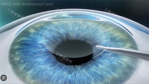 河源爱尔眼科好还是光明眼科好：深度对比爱尔眼科与光明眼科的强项、价格与口碑