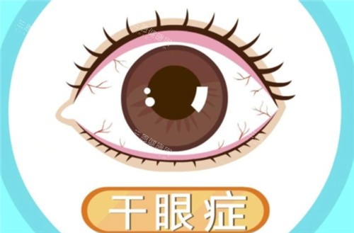 重度干眼症新希望！睑板腺移植手术是什么？适用人群、结果及费用完善解析！